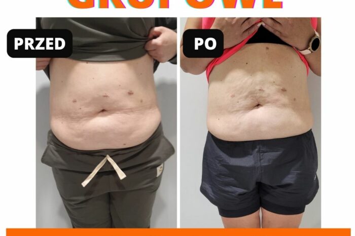 zajęcia grupowe + mag shape - metamorfoza